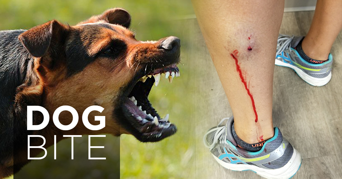 Dog Bite Lawsuit Guide